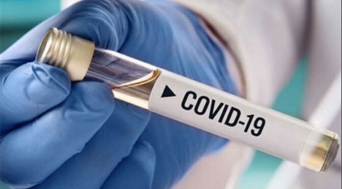 Із 27 січня по 2 лютого на Черкащині зареєстровано 146 випадків захворювання на COVID-19